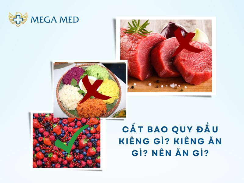 Cắt bao quy đầu kiêng gì? Cắt bao quy đầu kiêng ăn gì? Nên ăn gì không để lại sẹo và nhanh lành